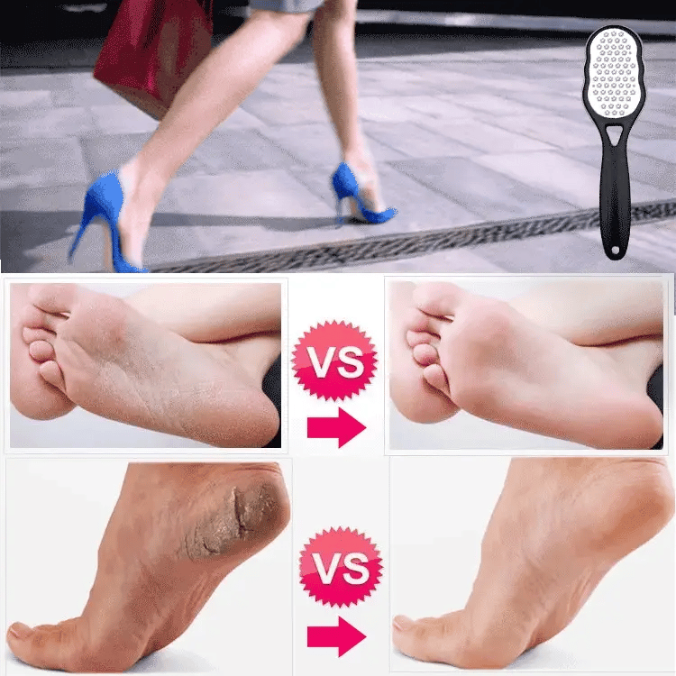 Stainless Steel Exfoliating Foot File