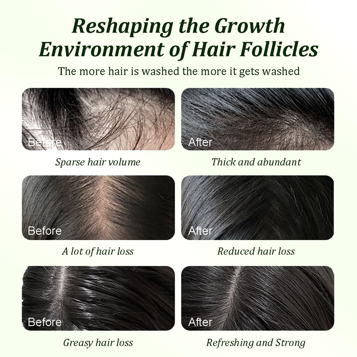 Batana Oil Shampoo for Hair Growth with Rosemary Extract🌱✨